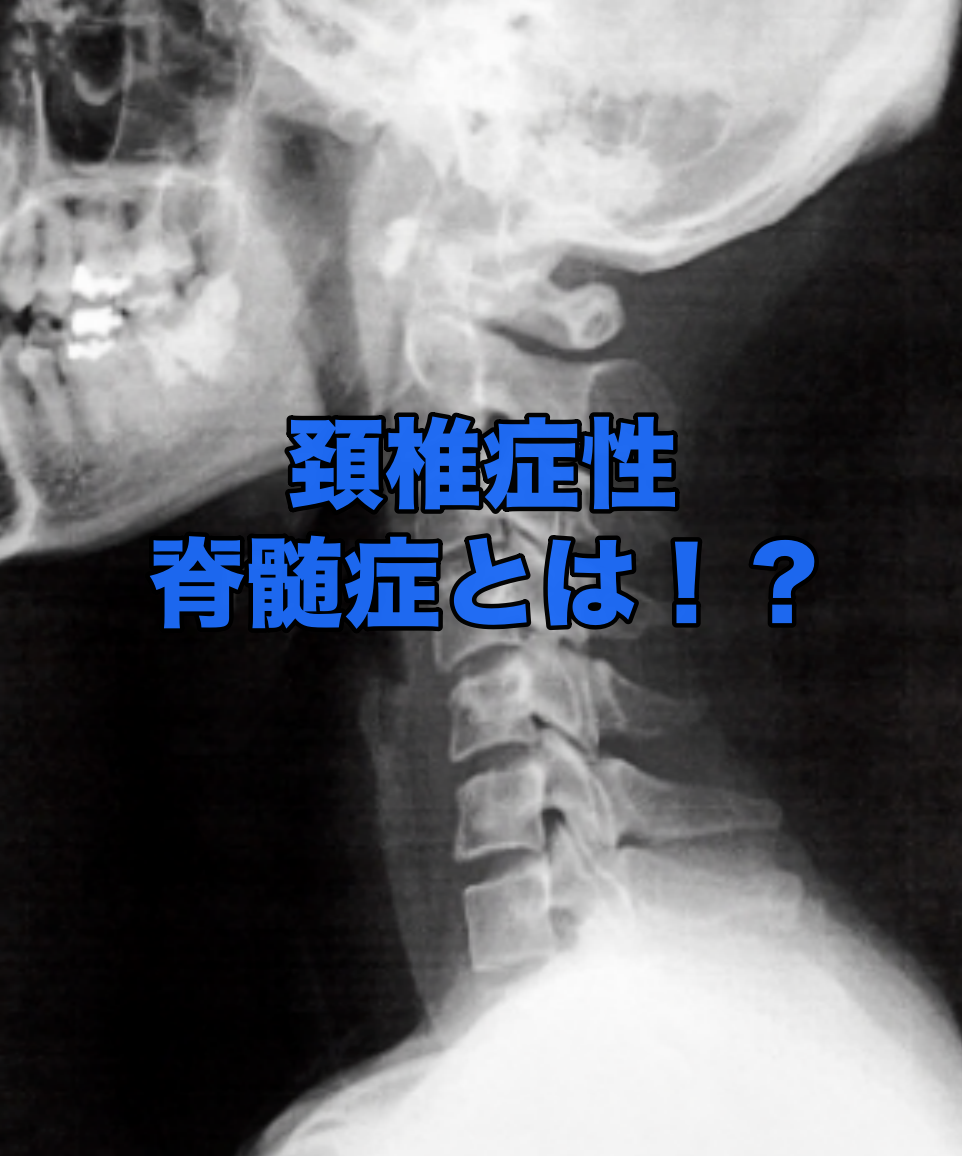 【整形外科】頚椎症性脊髄症に関して改めて勉強